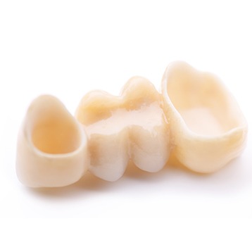 Bow Trail SW Dental Bridges | Nova Dental Care | General & Family Dentist | Bow Trail | SW Calgary