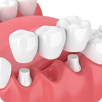 Bow Trail SW Restorative Dentistry | Nova Dental Care | General & Family Dentist | Bow Trail | SW Calgary