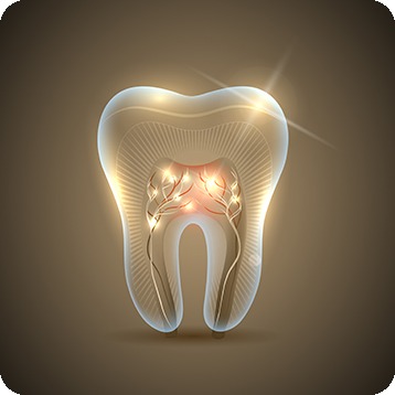 Bow Trail SW Root Canal Therapy | Nova Dental Care | General & Family Dentist | Bow Trail | SW Calgary