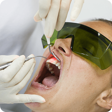 Bow Trail SW LANAP | Nova Dental Care | General & Family Dentist | Bow Trail | SW Calgary